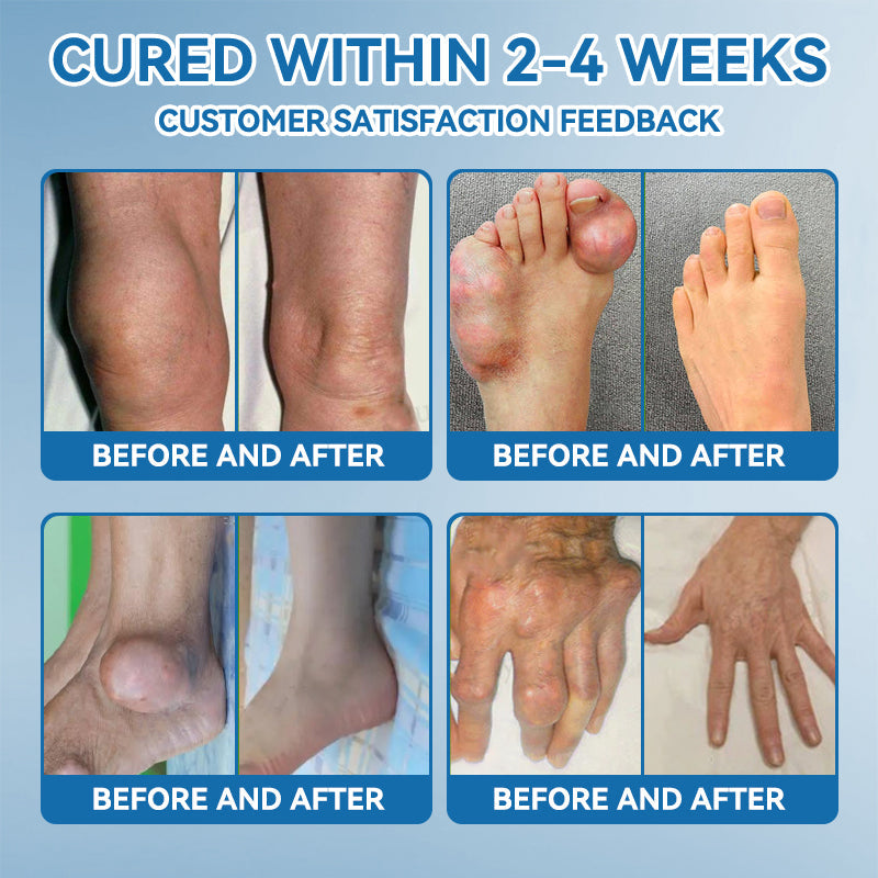 Croaie® BPC-157 Joint Healing Cream🦴Treats Arthritis, Neuropathy, Rheumatism, Sports Injuries & More🏆