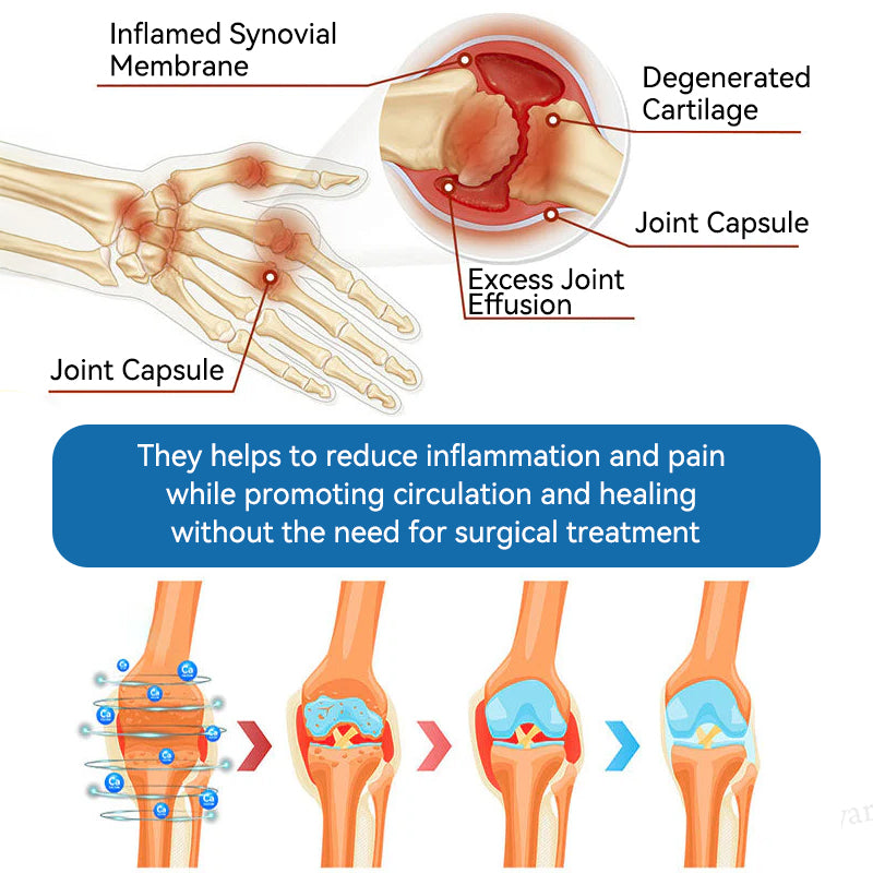 Croaie® BPC-157 Joint Healing Cream🦴Treats Arthritis, Neuropathy, Rheumatism, Sports Injuries & More🏆
