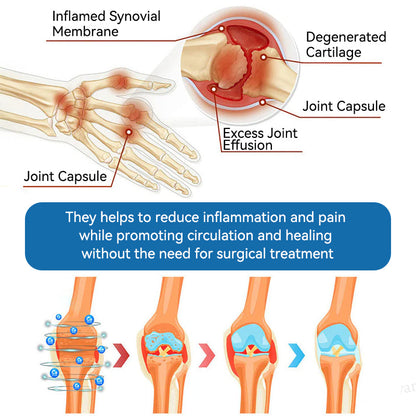Croaie® BPC-157 Joint Healing Cream🦴Treats Arthritis, Neuropathy, Rheumatism, Sports Injuries & More🏆