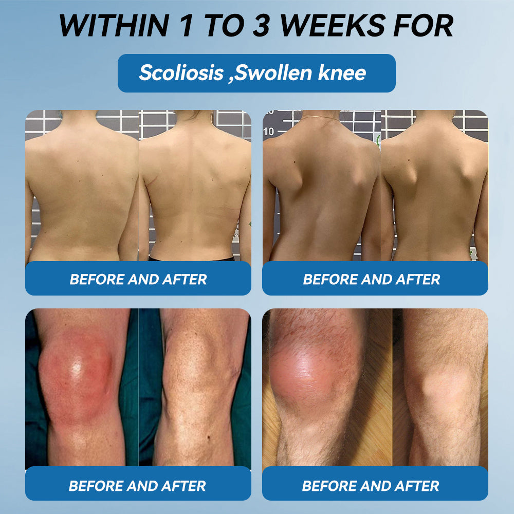 Croaie® BPC-157 Joint Healing Cream🦴Treats Arthritis, Neuropathy, Rheumatism, Sports Injuries & More🏆