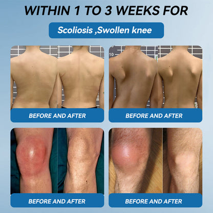 Croaie® BPC-157 Joint Healing Cream🦴Treats Arthritis, Neuropathy, Rheumatism, Sports Injuries & More🏆