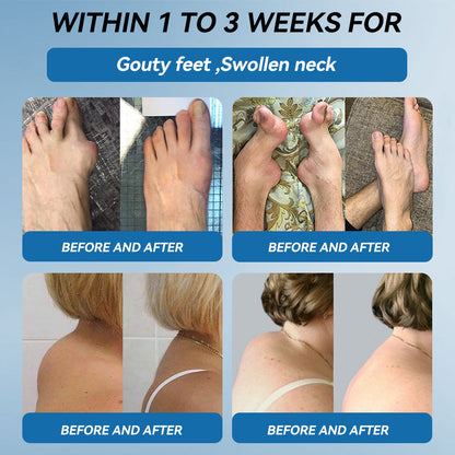 Croaie® BPC-157 Joint Healing Cream🦴Treats Arthritis, Neuropathy, Rheumatism, Sports Injuries & More🏆