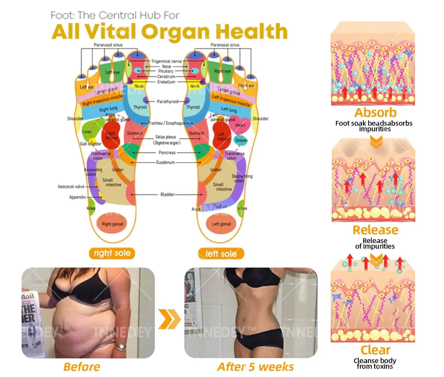 𝐓𝐧𝐧𝐞𝐝𝐞𝐲® 𝐁𝐞𝐞 𝐕𝐞𝐧𝐨𝐦 & 𝟑𝟎-𝐇𝐞𝐫𝐛 𝐃𝐞𝐭𝐨𝐱 𝐅𝐨𝐨𝐭 𝐒𝐨𝐚𝐤 𝐁𝐞𝐚𝐝𝐬 𝐟𝐨𝐫 𝐁𝐨𝐝𝐲 𝐒𝐜𝐮𝐥𝐩𝐭𝐢𝐧𝐠- Recommended by the Australian Orthopaedic Association (AOA)⚡🏆