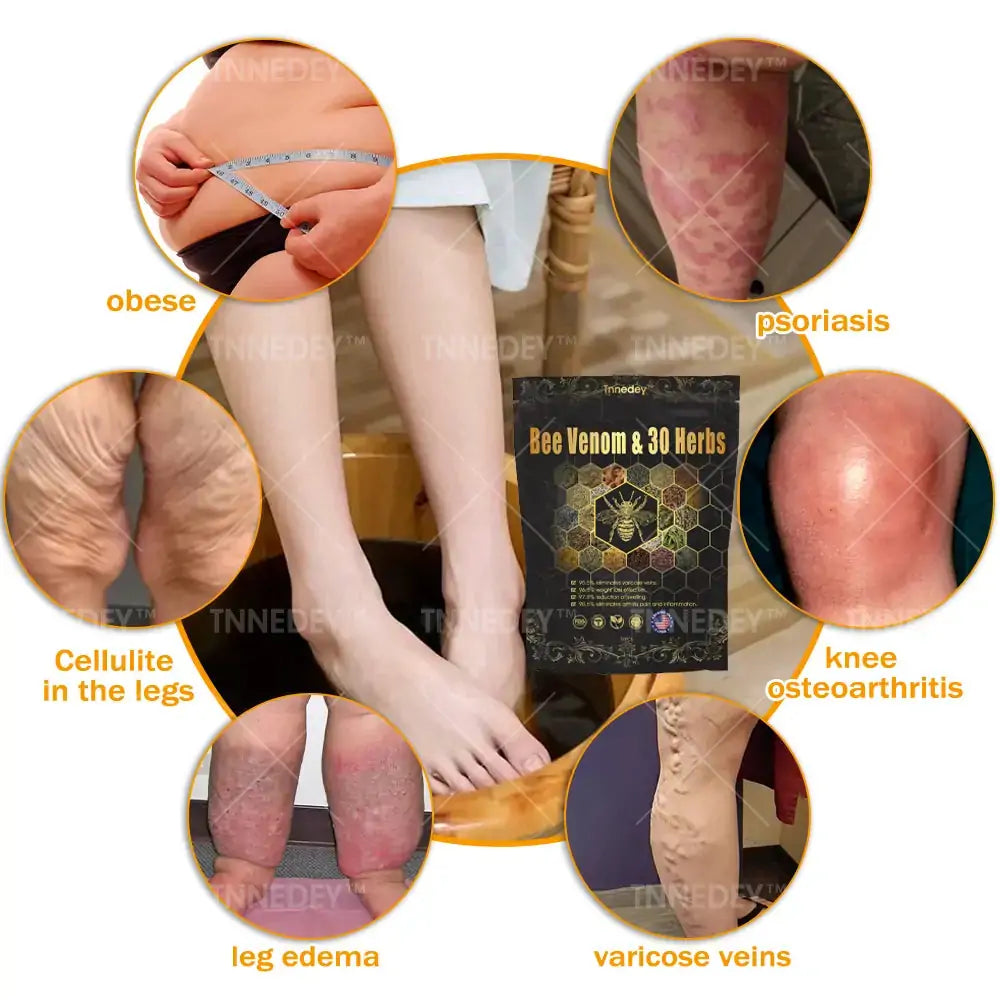 𝐓𝐧𝐧𝐞𝐝𝐞𝐲® 𝐁𝐞𝐞 𝐕𝐞𝐧𝐨𝐦 & 𝟑𝟎-𝐇𝐞𝐫𝐛 𝐃𝐞𝐭𝐨𝐱 𝐅𝐨𝐨𝐭 𝐒𝐨𝐚𝐤 𝐁𝐞𝐚𝐝𝐬 𝐟𝐨𝐫 𝐁𝐨𝐝𝐲 𝐒𝐜𝐮𝐥𝐩𝐭𝐢𝐧𝐠- Recommended by the Australian Orthopaedic Association (AOA)⚡🏆